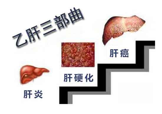 郑州肝病医院那家好