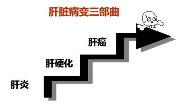 郑州哪个医院治疗肝硬化?郑州哪里看肝硬化好