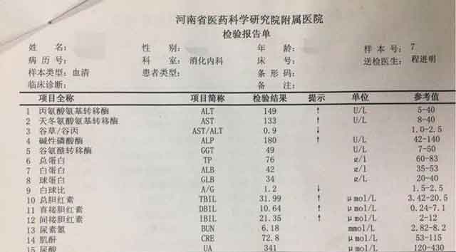 郑州看肝硬化哪个医院好?郑州治疗肝硬化几家医院好