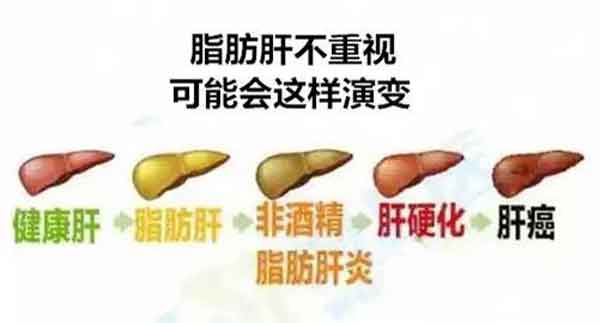 河南省哪家医院看肝病好?郑州的肝病医院