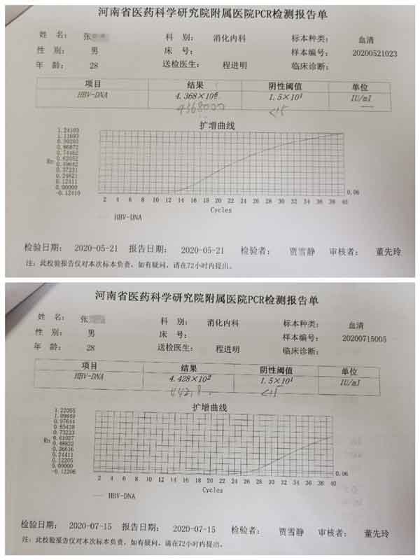 郑州看乙肝大三阳病哪个医院好